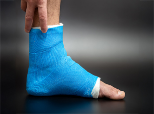 Tips for Ankle Fracture Recovery